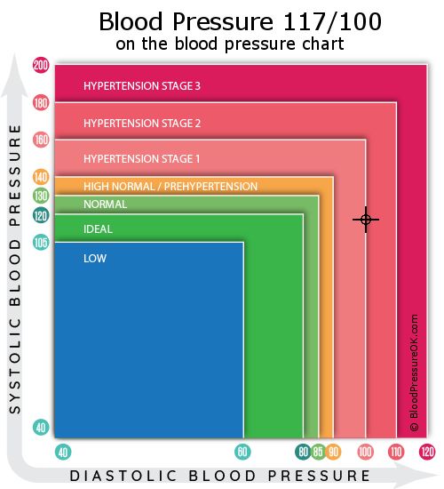 Blood Pressure 117 over 100 on the blood pressure chart