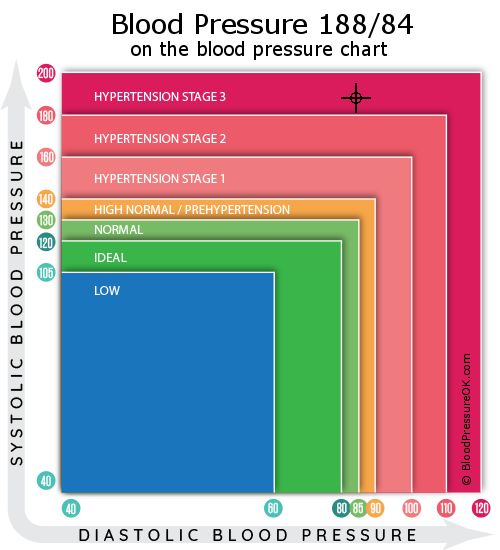 Blood Pressure 188 over 84 on the blood pressure chart