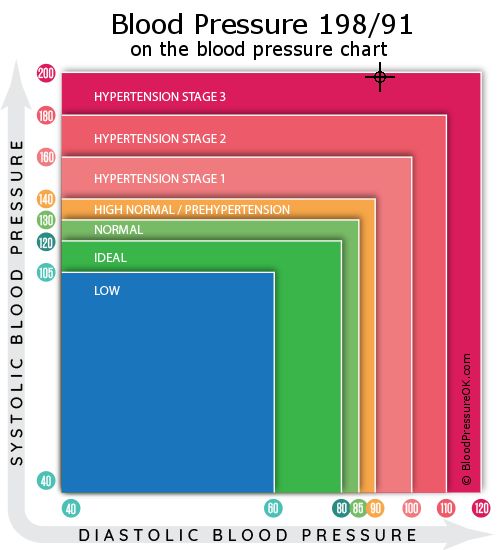 Blood Pressure 198 over 91 on the blood pressure chart