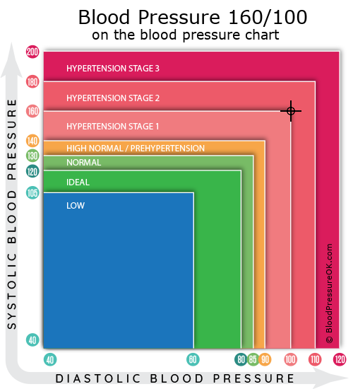 blood-pressure-160-over-100-good-or-bad-bloodpressureok