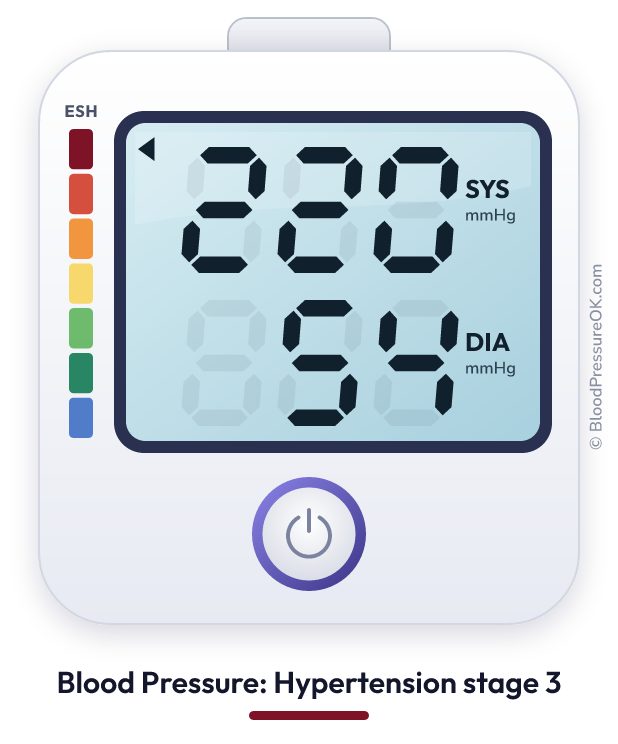 Blood pressure 220 over 54 on the blood pressure monitor