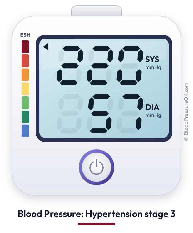 Blood pressure 220 over 57 on the blood pressure monitor