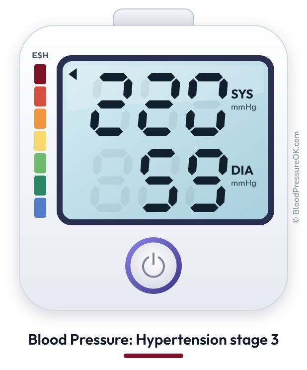 Blood pressure 220 over 59 on the blood pressure monitor