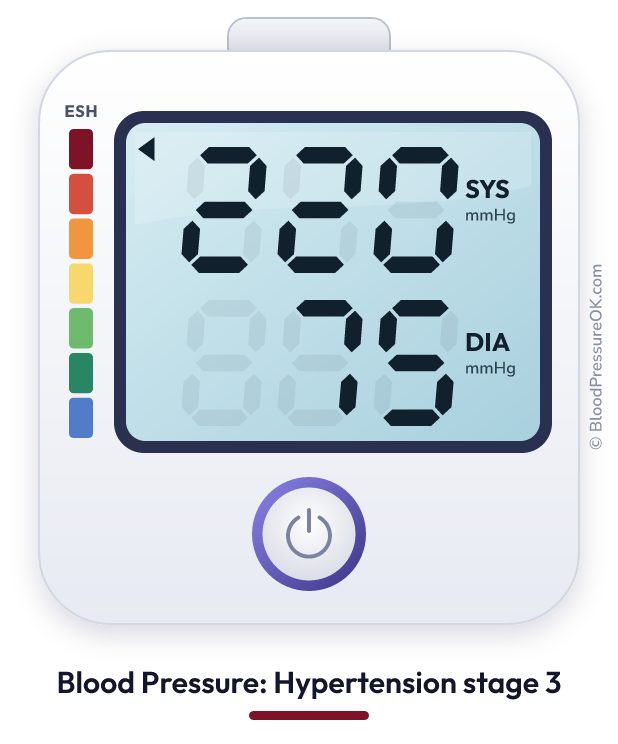 Blood pressure 220 over 75 on the blood pressure monitor