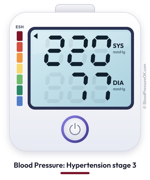 Blood pressure 220 over 77 on the blood pressure monitor