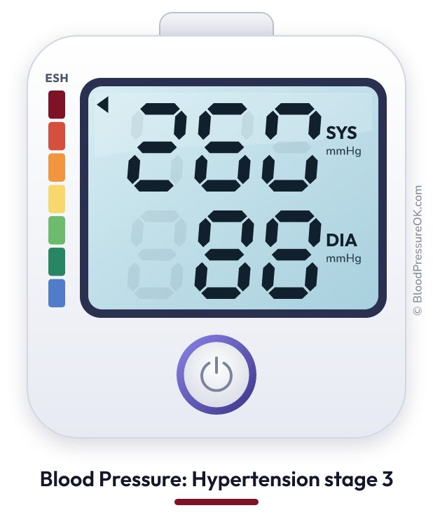 Blood pressure 260 over 88 on the blood pressure monitor