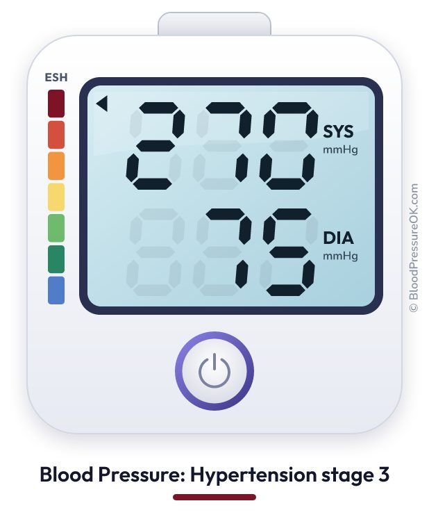 Blood pressure 270 over 75 on the blood pressure monitor