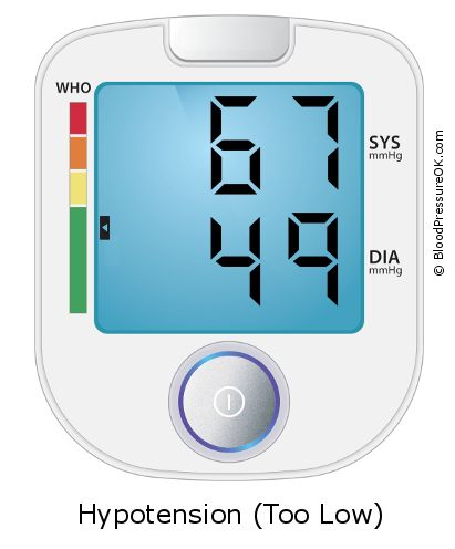 Blood Pressure 67 over 49 on the blood pressure monitor