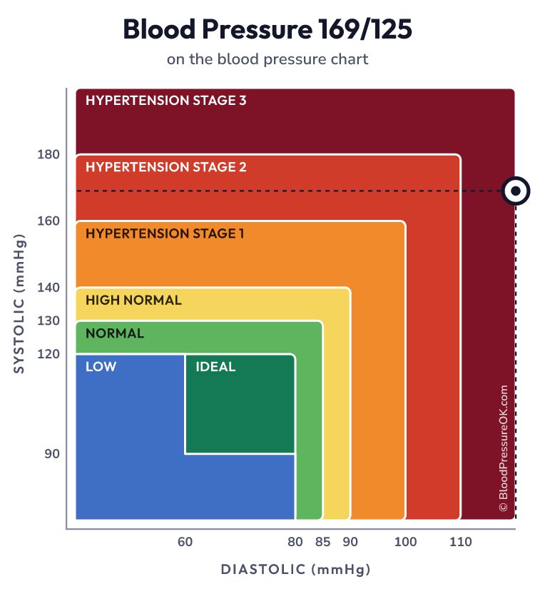 Blood pressure 169 over 125 on the blood pressure chart