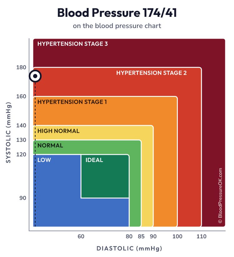 Blood pressure 174 over 41 on the blood pressure chart