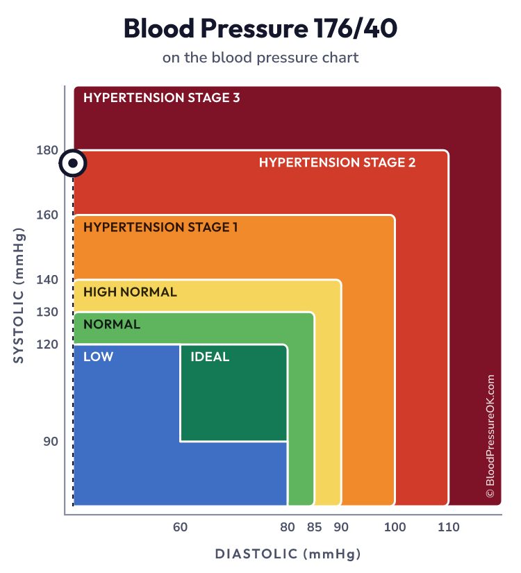 Blood pressure 176 over 40 on the blood pressure chart