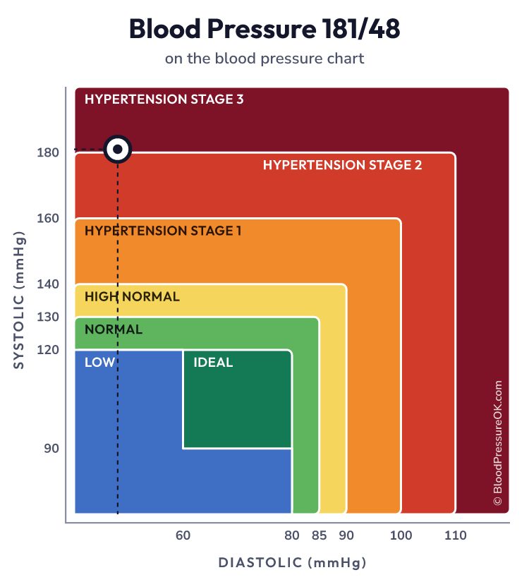 Blood pressure 181 over 48 on the blood pressure chart