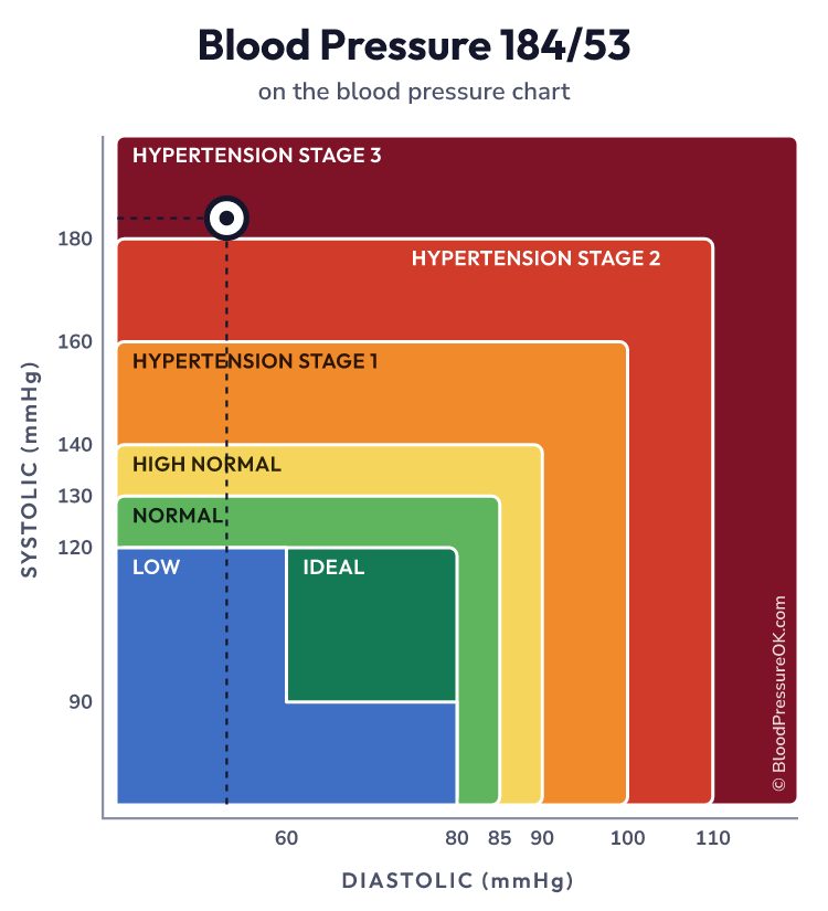 Blood pressure 184 over 53 on the blood pressure chart