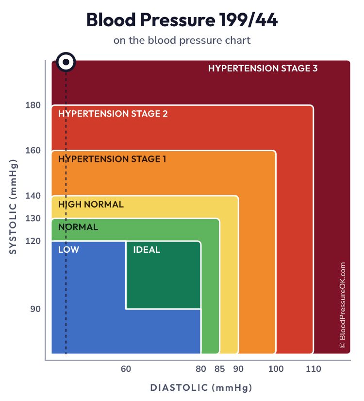Blood pressure 199 over 44 on the blood pressure chart
