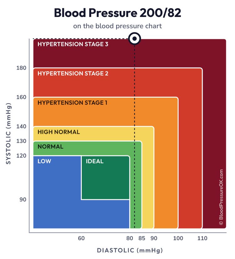 Blood pressure 200 over 82 on the blood pressure chart