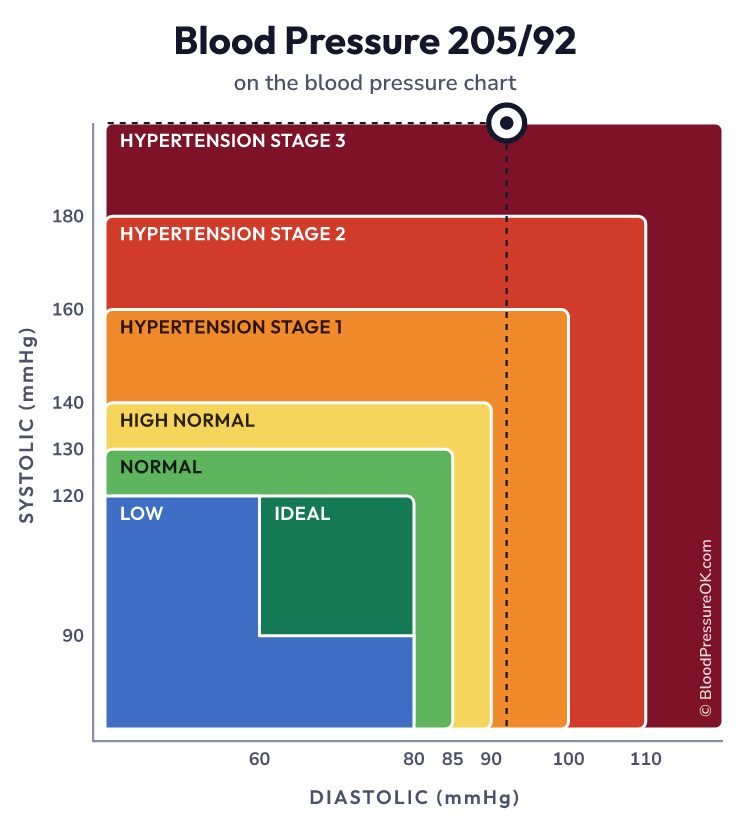 Blood pressure 205 over 92 on the blood pressure chart