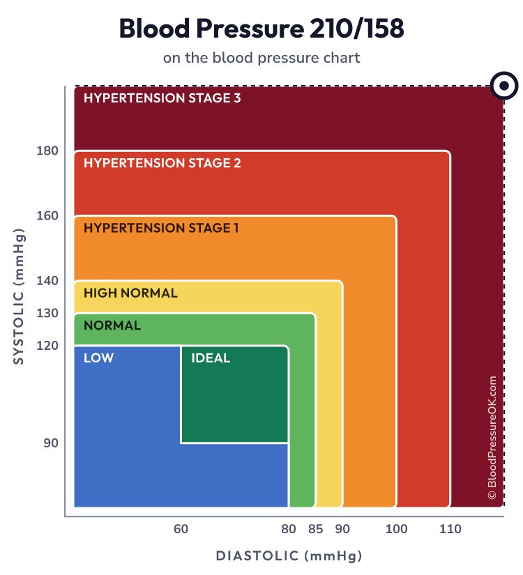 Blood pressure 210 over 158 on the blood pressure chart