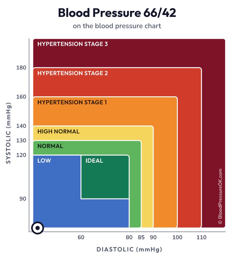 Blood pressure 66 over 42 on the blood pressure chart